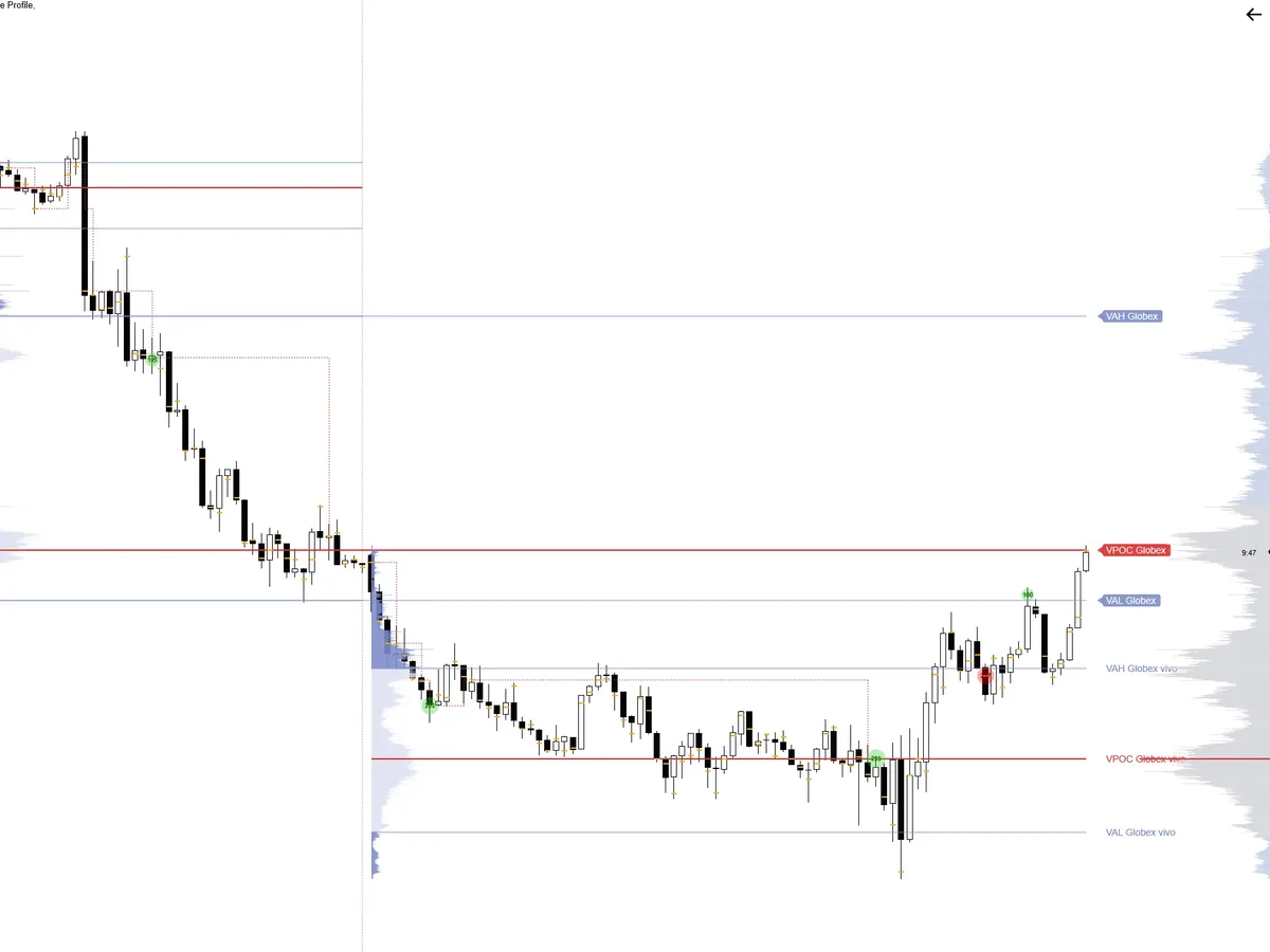 TW Volume Profile en NinjaTrader 8: perfil del día previo y del día en curso con VAH, VPOC y VAL, y perfil del rango visible